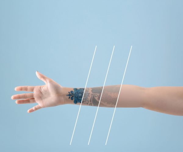 Young woman before and after laser tattoo removal procedure on color background, closeup