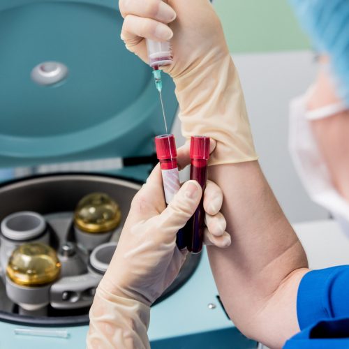 Platelet-Rich plasma preparation. Plasma in syringe. Centrifuge. Background
