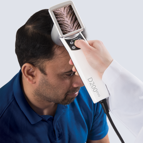HairMetrix-capturing close-up