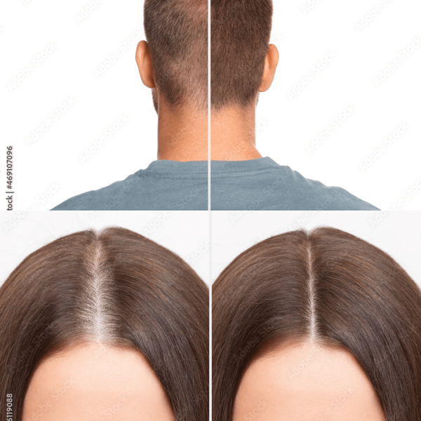 Montage Haarausfall Landingpage Studie Entwurf 2-min